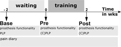 Leg Prosthesis With Somatosensory Feedback Reduces Phantom Limb Pain and Increases Functionality